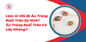 Lam-Gi-Khi-Bi-Au-Trung-Ruoi-Trau-Ky-Sinh-Au-Trung-Ruoi-Trau-Co-Lay-Khong