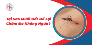 Tai-Sao-Muoi-Dot-De-Lai-Cham-Do-Khong-Ngua